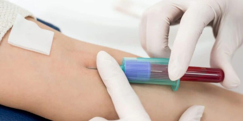 a-simple-blood-test-that-can-detect-cancer?-understanding-liquid-biopsy
