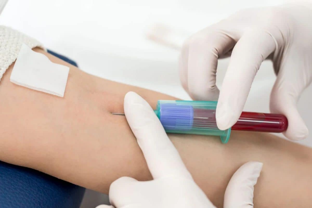 a-simple-blood-test-that-can-detect-cancer?-understanding-liquid-biopsy